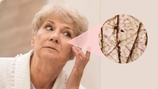 This 65 year old’s skin sags over weak, loose collagen and elastin proteins
