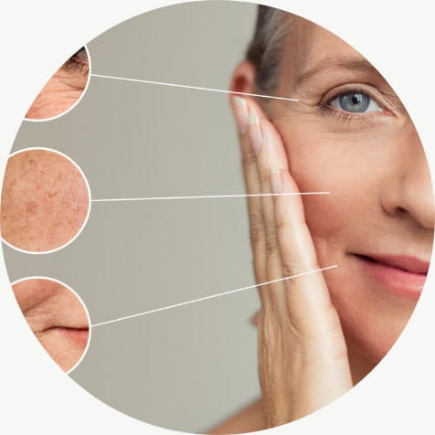 Skin problems appear as you age