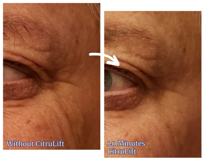 Smooth Out Crow’s Feet & Wrinkles